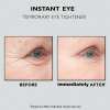 🔥Last Day 49% OFF🎁Instant Eye Temporary Eye Tightener🎁