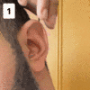 🔥Last Day Promotion 70% OFF🔥925 Silver - Aesthetic Ear Correction without Surgery