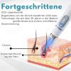 🏆Letzter Tag 49% Rabatt🔥Nicht-invasiv Leberfleck&Warzenentfernungs-Laserstift