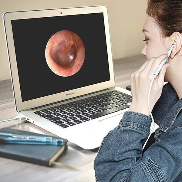 (🔥Sunmer Hot Sale - 50% OFF)USB Endoscope, Buy 2 Get 1 FREE NOW