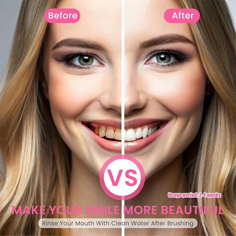 🦷Niacinamide Whitening Toothpaste - For Healthier, Whiter Teeth!✨