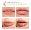 DEROL™ LIP PLUMPER KIT