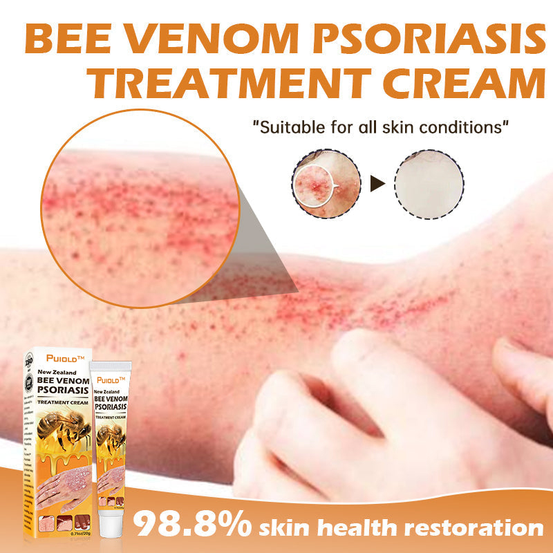 New Zealand Bee Venom Psoriasis Treatment Cream(Suitable for all skin conditions)- BUY 1 GET 1 FREE