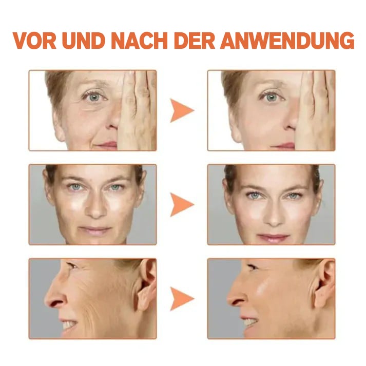 OTEH™-PEPTIDE Wrinkle Reducing Cream enthält 12 verschiedene Peptide (beseitigt Falten in 1 Minute)