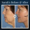 BeautyRest + Anti-Snoring V-Face Beauty Device-BUY 2 FREE SHIPPING