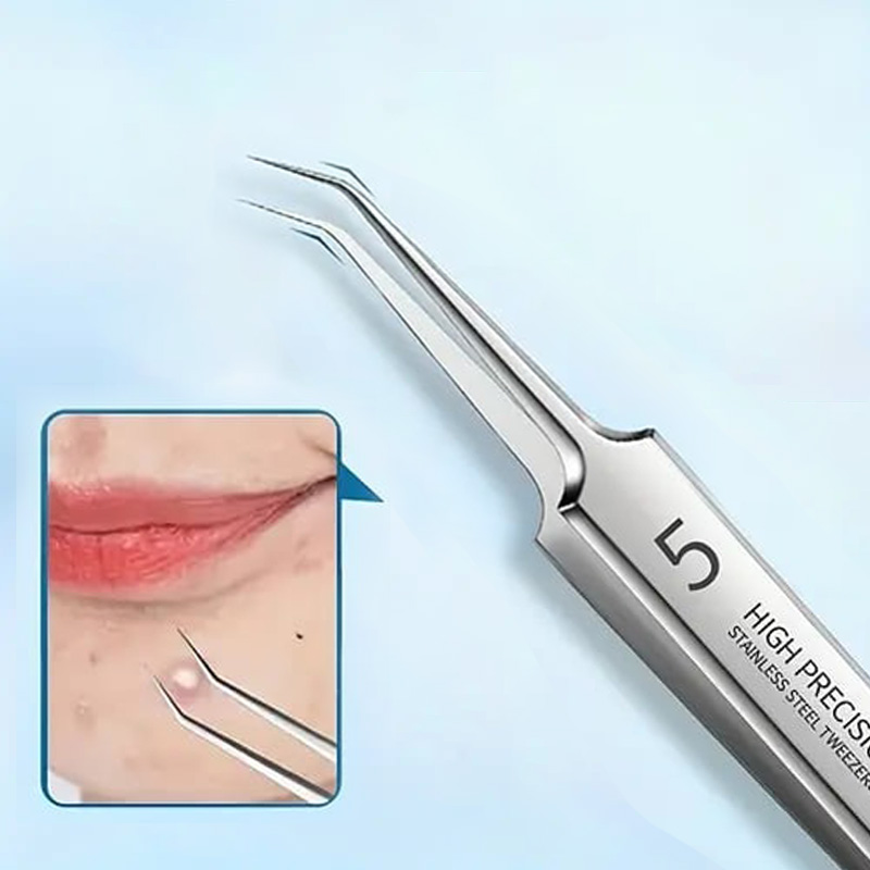 💥LAST DAY SALE 70% OFF💥Professional Facial Blackhead Remover Tweezers