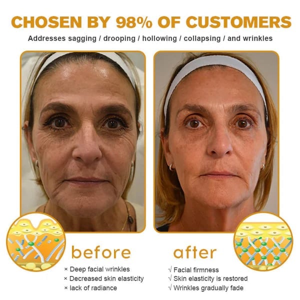 (Made and Shipped from USA) 🧑‍⚕️NEGUSY® Botox Bee Venom Wrinkle Removal Cream