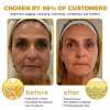 (Made and Shipped from USA) 🧑‍⚕️NEGUSY® Botox Bee Venom Wrinkle Removal Cream