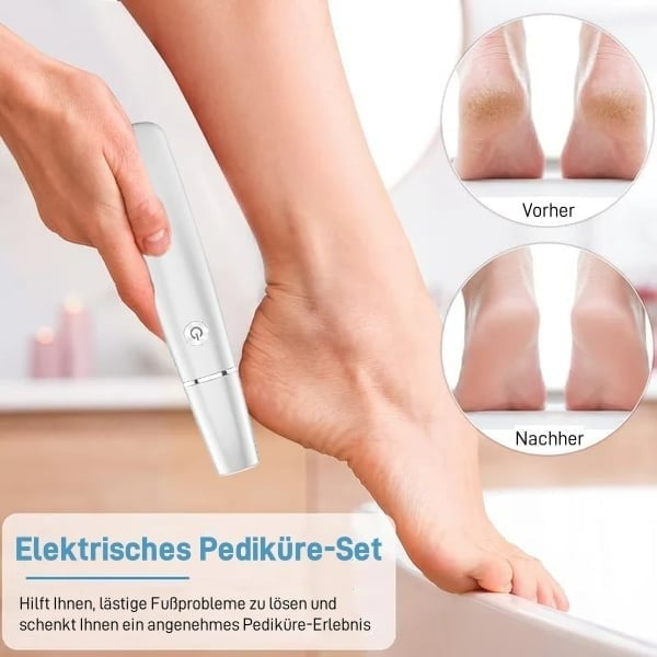 🔥Letzter Tag 50% RABATT- Sonderangebot - Elektrischer Hornhautentferner für die Füße