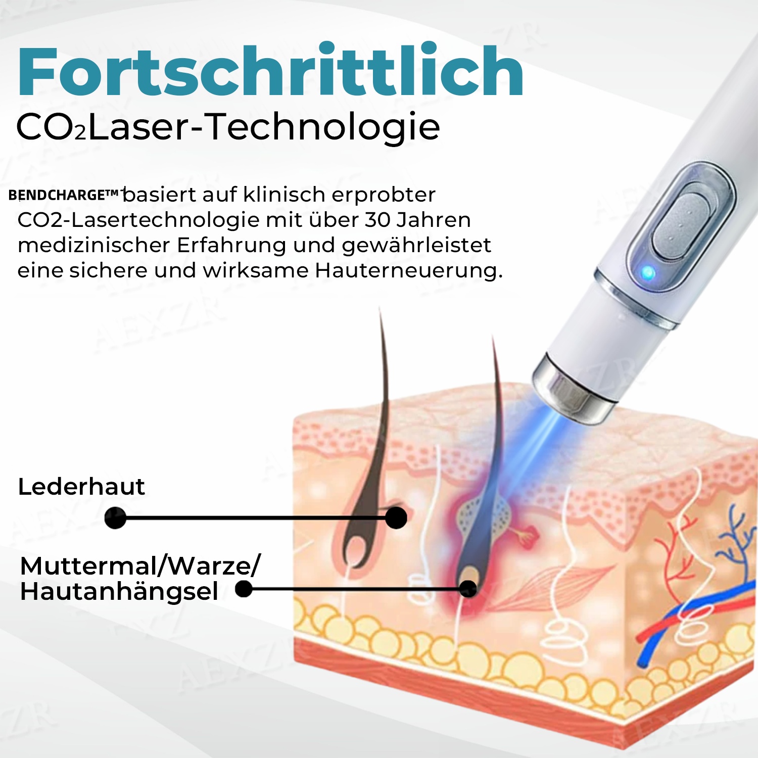 🎁-✨BENDCHARGE™ Nicht-invasiver Laser-Stift zur Entfernung von Muttermalen und Warzen✨