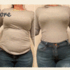 Women Reducing Girdle Posture Corrector Bra❤️Buy 2 Free Shipping