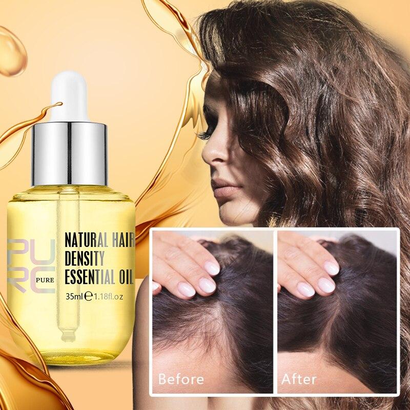 🔥2024 Best Sales🔥PURC Hair Growth Oil(Fast Hair Growth - Prevent Hair Less)