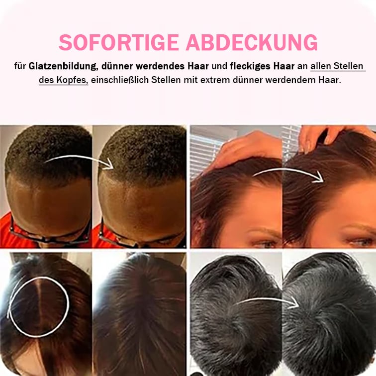 🔥Letzter Tag 49% Rabatt 💕Das perfekte Werkzeug zum Auffüllen des Haaransatzes