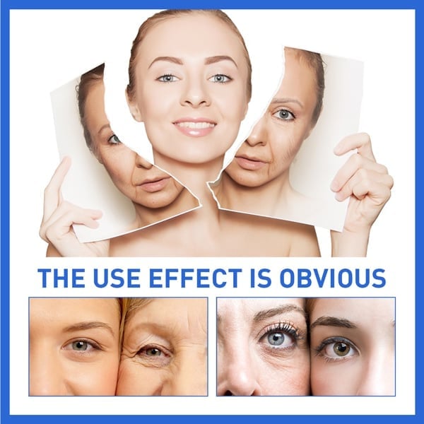 Last Day Promotion 49% OFF - 🔥Botox Face Serum