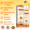 🔥Last Day Promotion 70% OFF💥Cvreoz® Bee Venom Nail Renewal Spray