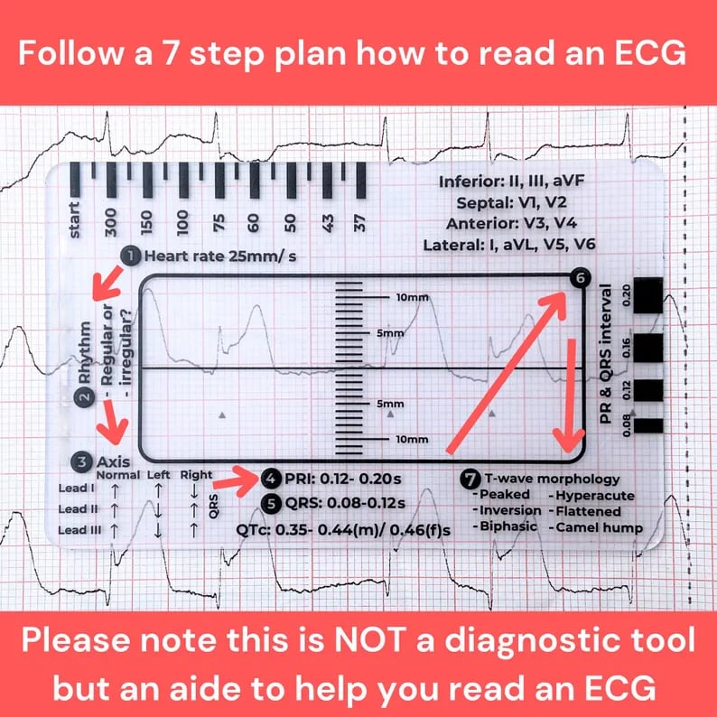 ✨TikTok Black Friday Deals - 70% OFF🎁ECG 7 Step Ruler