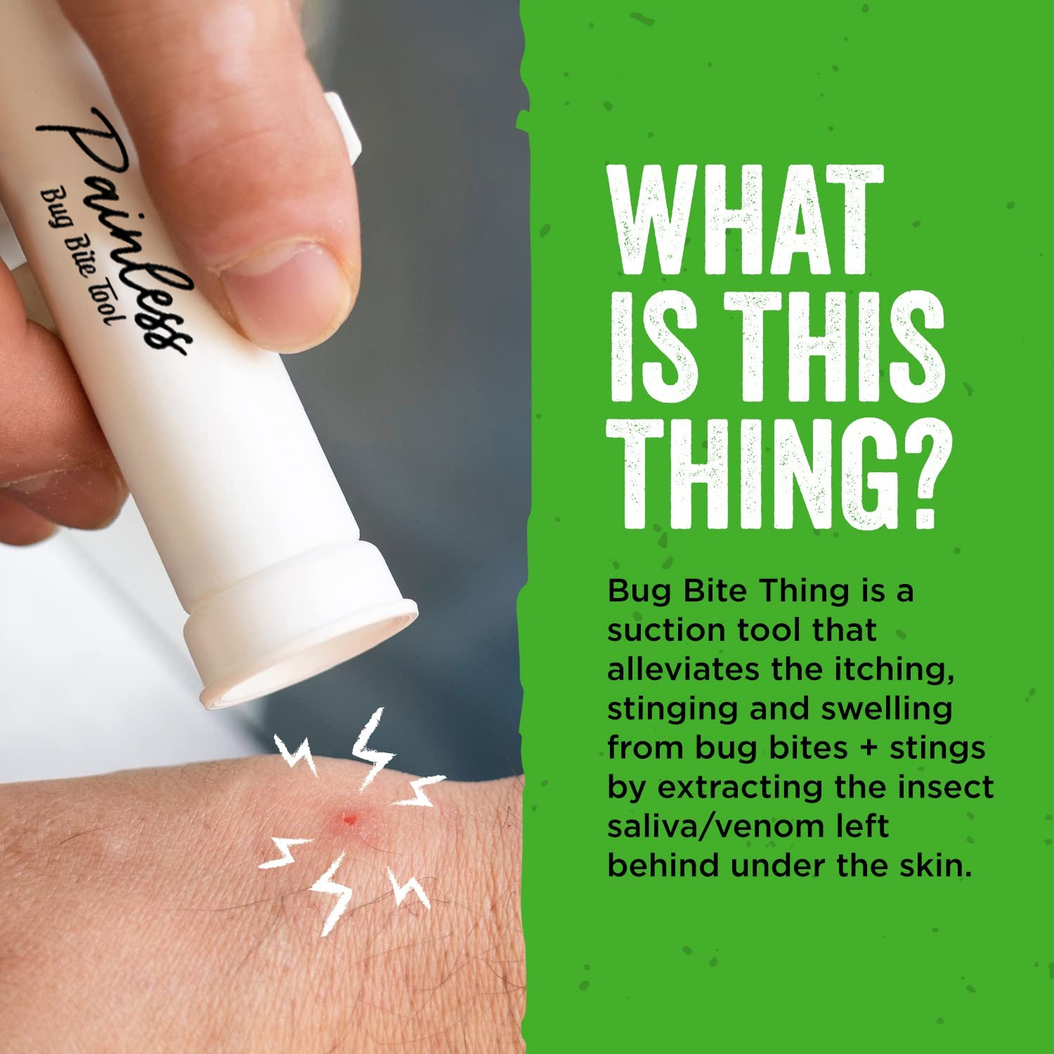 🔥🔥2025 HOT SALE - Bug Bite Thing Insect Bite and Sting Suction Tool