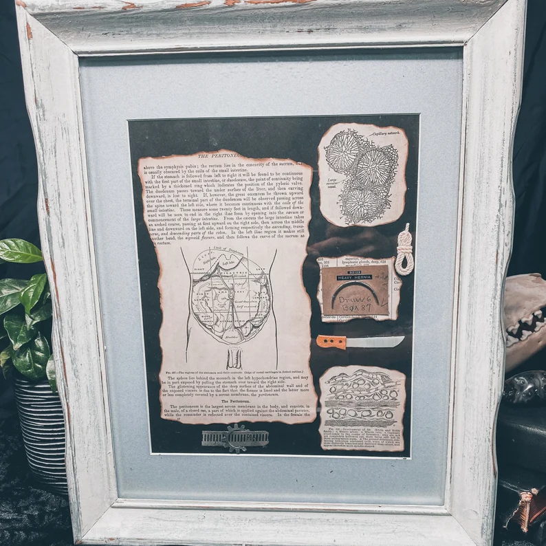 Lobotomy Shadowbox Display