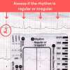 ECG 7 Step Ruler