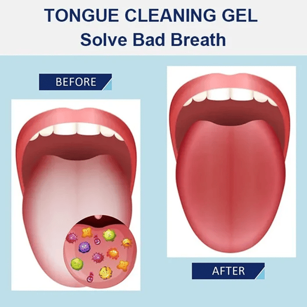 🔥2023New Year Sale -Probiotic Tongue Cleaning Gel Set(🔥Buy 4 get 4 Free & Free Shipping)