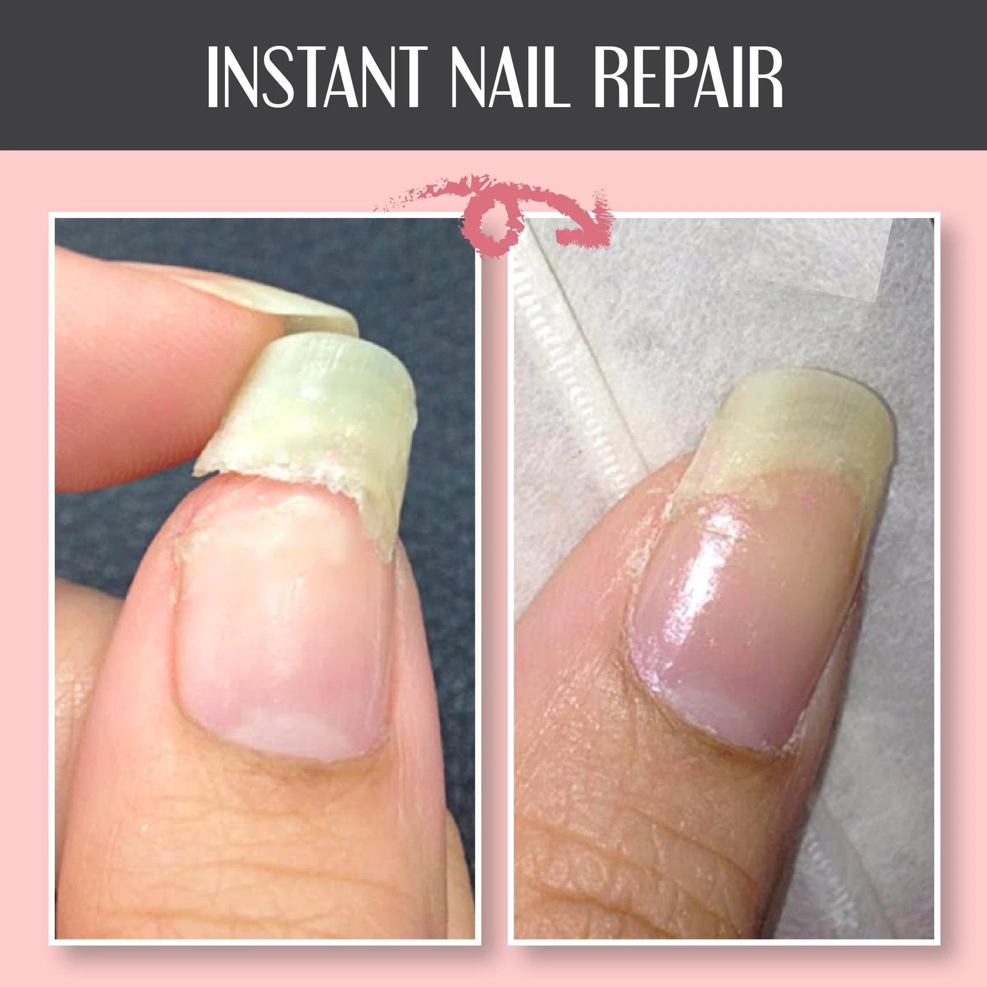 🔥Nail Repair Protection Gel