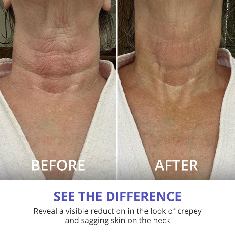 Tighten & Lift Neck Cream