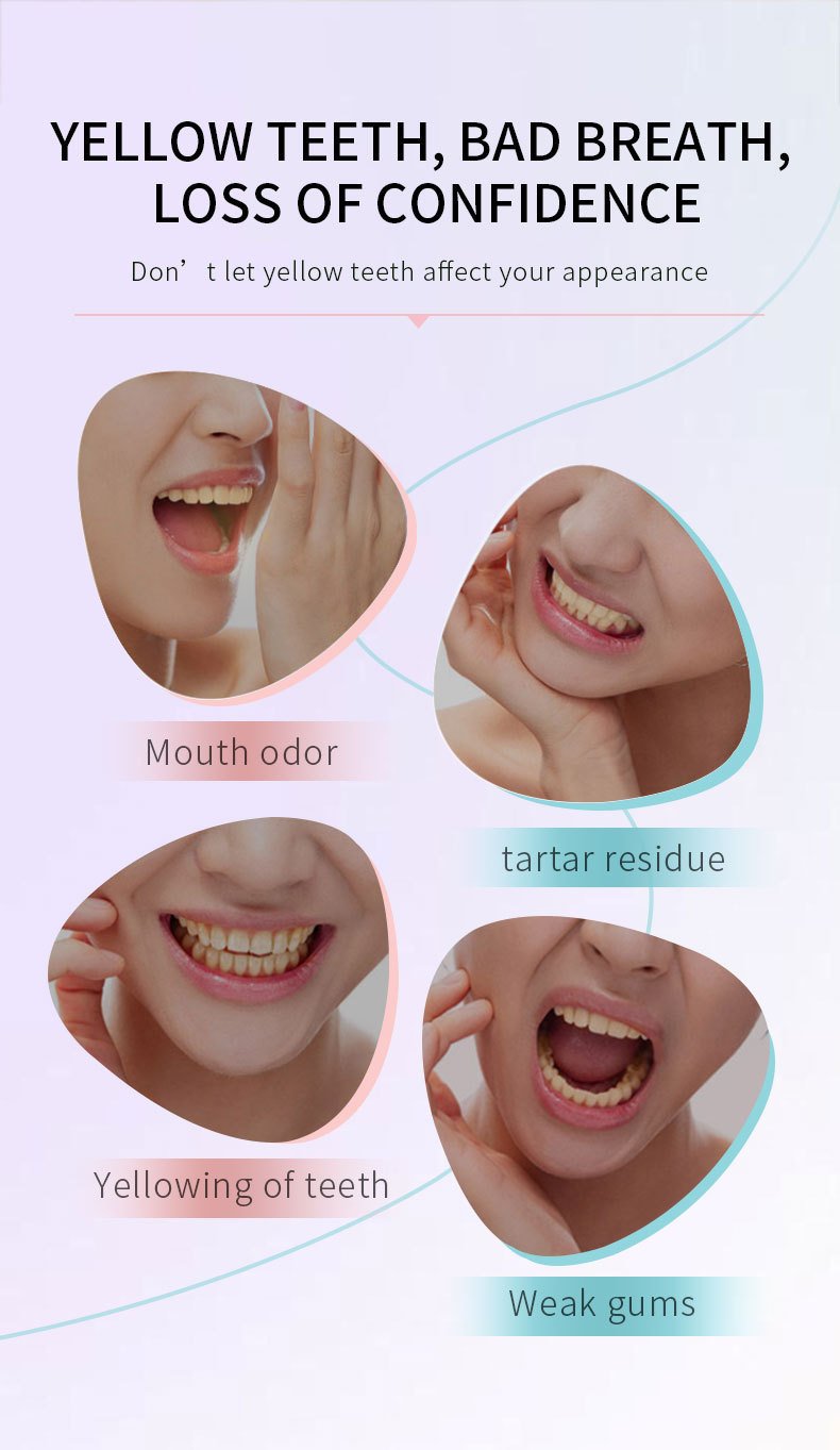 🔥Last Day Sale 49% OFF🔥Niacinamide Whitening Toothpaste