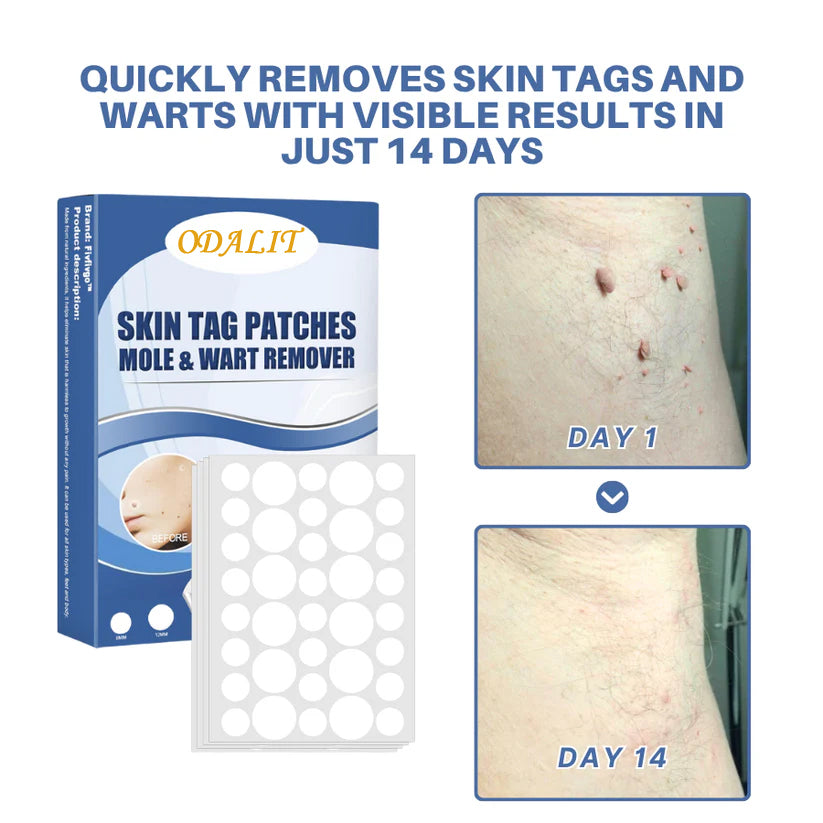 ⏰LAST DAY SALE 50% OFF💥Natural Skin Tag and Wart Removal Patches
