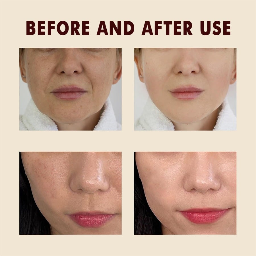 🔥Peel Shot Glow Rice Ampoule Duo
