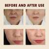 🔥Peel Shot Glow Rice Ampoule Duo