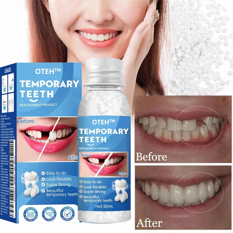 OTEH™ – The Ultimate Temporary Tooth Repair Solution for a Perfect Smile
