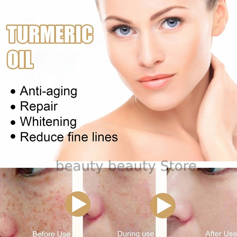 🔥2023 HOT SLAE 50% OFF🎁Turmeric Spot Correcting Serum