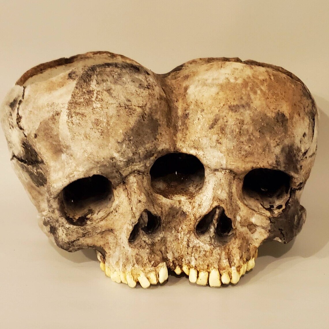 Conjoined Twins Human Skull Sculpture or Planter