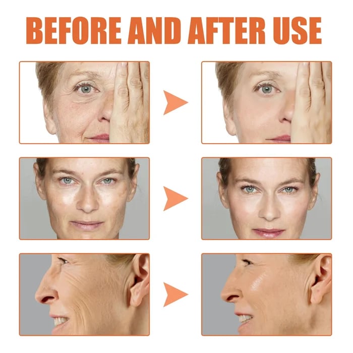 🔥Last Day Promotion 50% OFF🔥Botox Face Serum - Buy 3 Get 1 Free