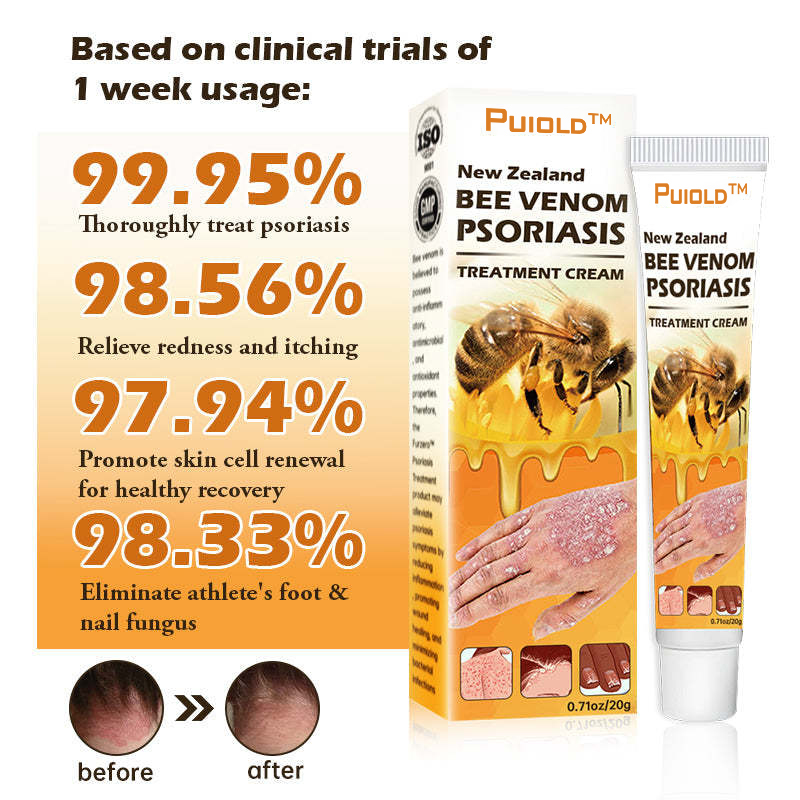 🏥Puiold™ New Zealand Bee Venom Psoriasis Treatment Cream(Suitable for all skin conditions)