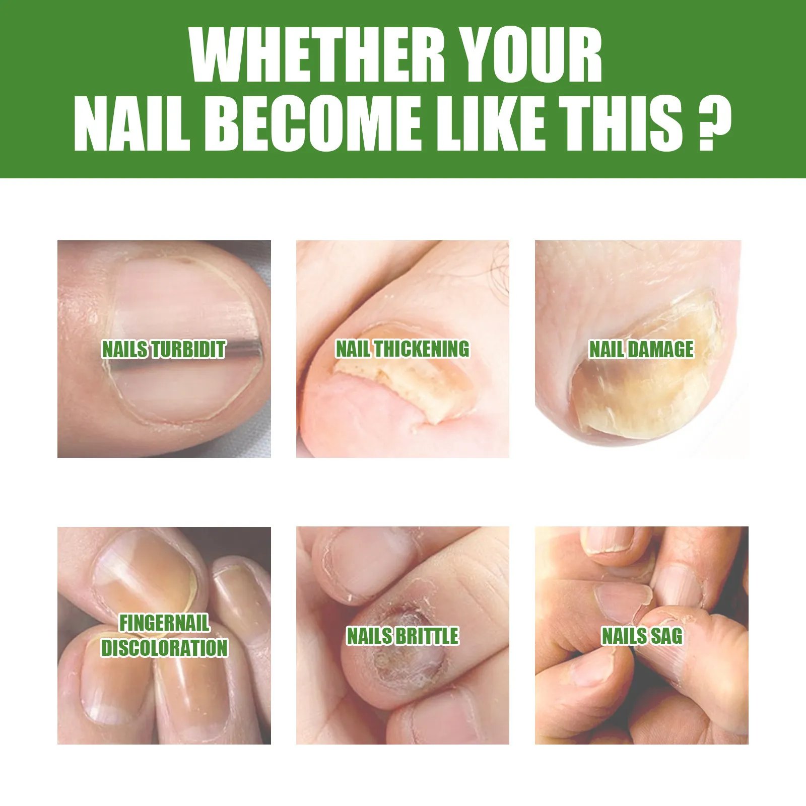 🔥Last Day Promotion 50% OFF🔥Kill and Prevent Nail Fungus Fast!-The Best Medi-Care Toe Nail Stick🖐