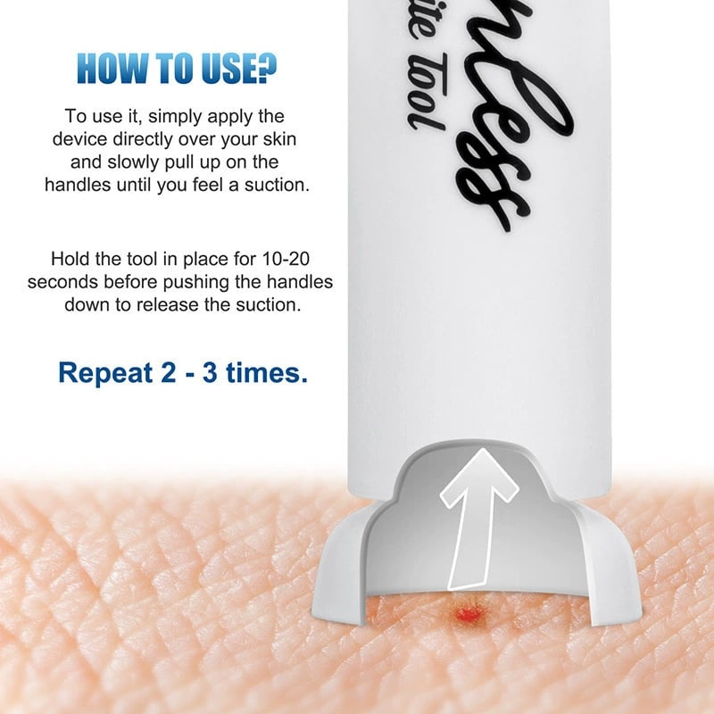 🦟 Experience Instant Relief - 49% OFF - ✨ Ultimate Bite & Sting Relief Tool - For Itch-Free, Comfortable Days!