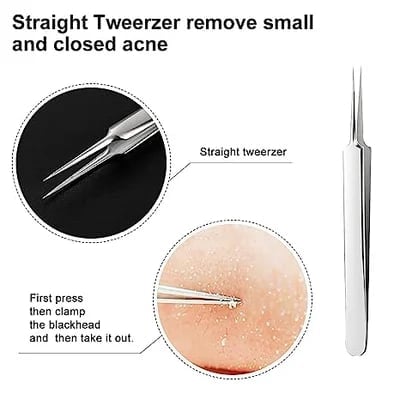 🔥Professional Facial Blackhead Remover Tweezers