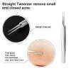 🔥Professional Facial Blackhead Remover Tweezers