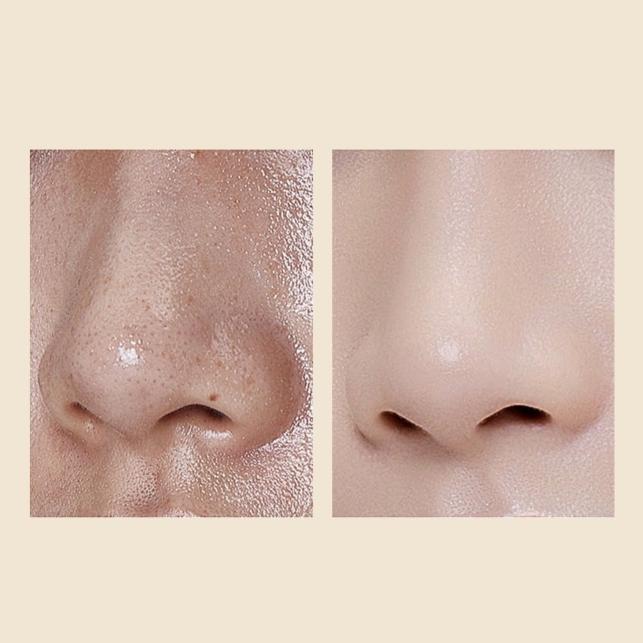 🔥Peel Shot Glow Rice Ampoule Duo