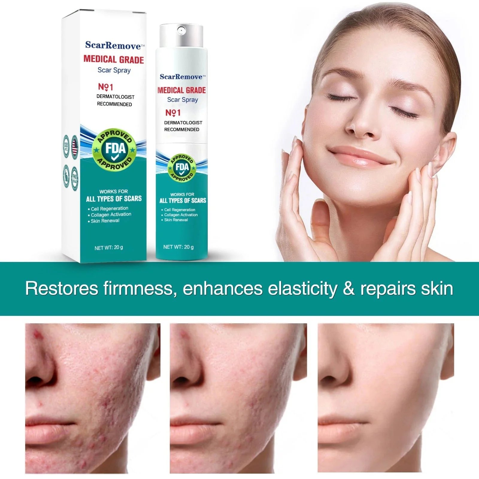 ❤️ScarRemove™ Advanced Scar Spray For All Types of Scars - For example Acne Scars, Surgical Scars and Stretch Marks🔥