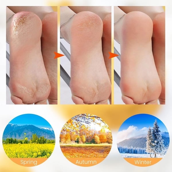 💥LAST DAY SALE 50% OFF💥Foot Spa Moisturizing Exfoliating Silicone Socks⚡BUY 3 GET 1 FREE