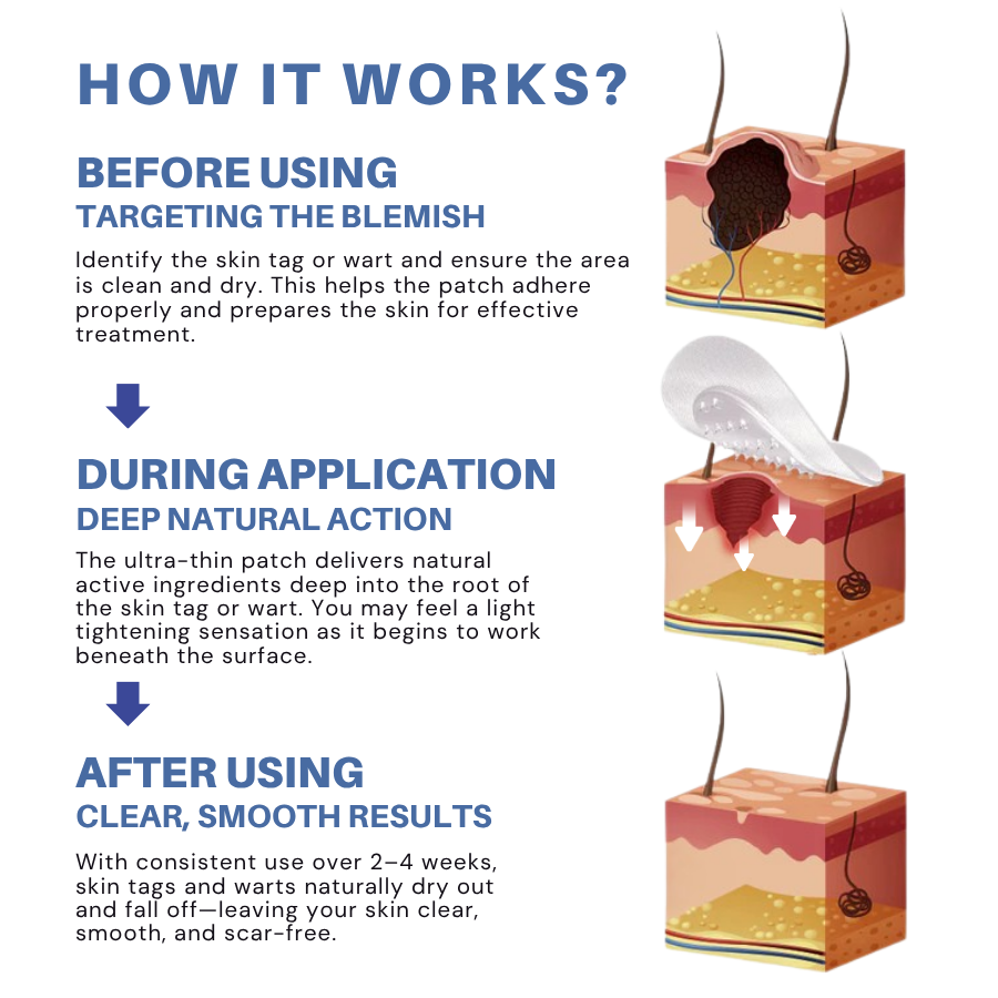 ⏰LAST DAY SALE 50% OFF💥Natural Skin Tag and Wart Removal Patches