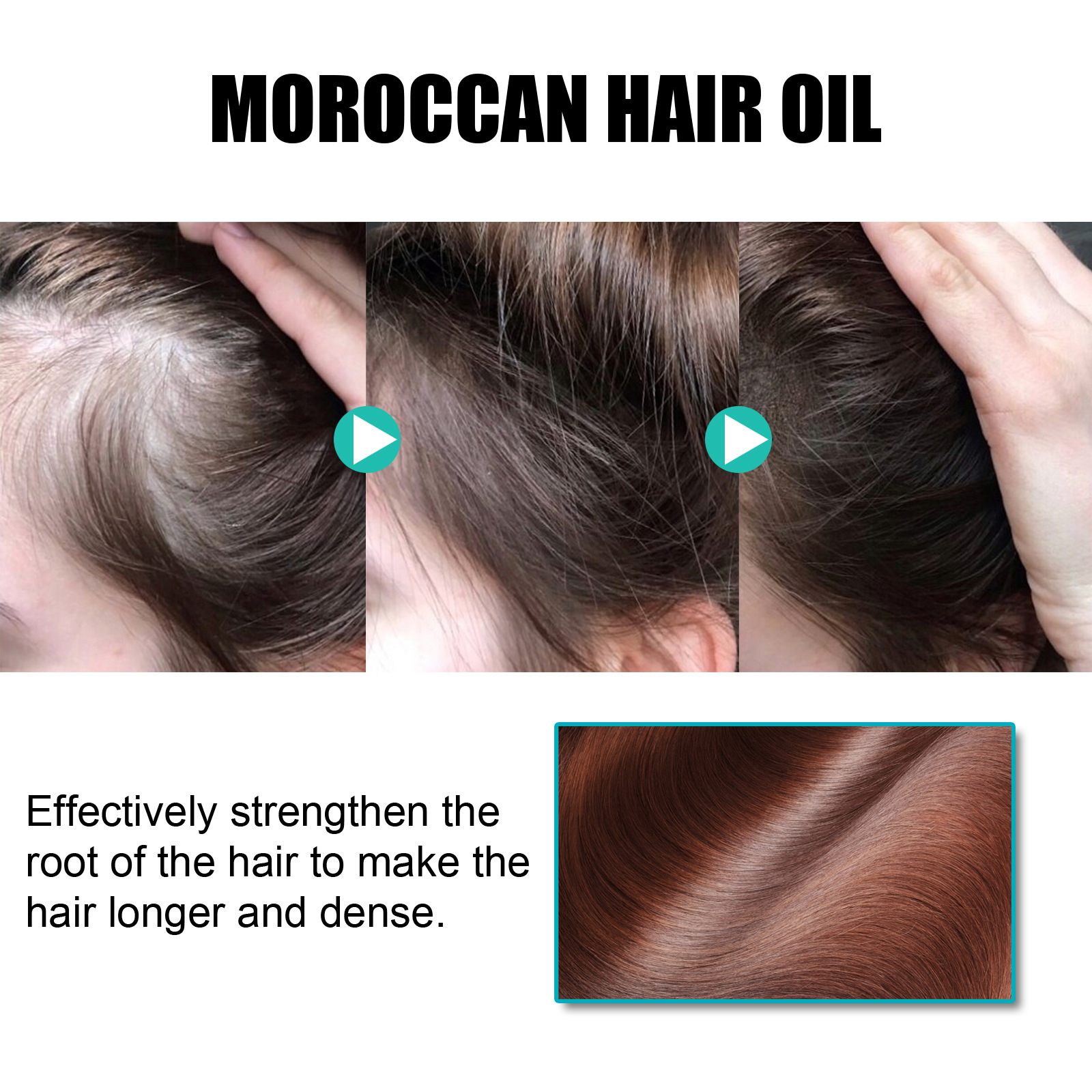 🔥Last Day Promotion 48% OFF-🎁- Hoegoa ZenithGrowth Moroccan Hair Oil