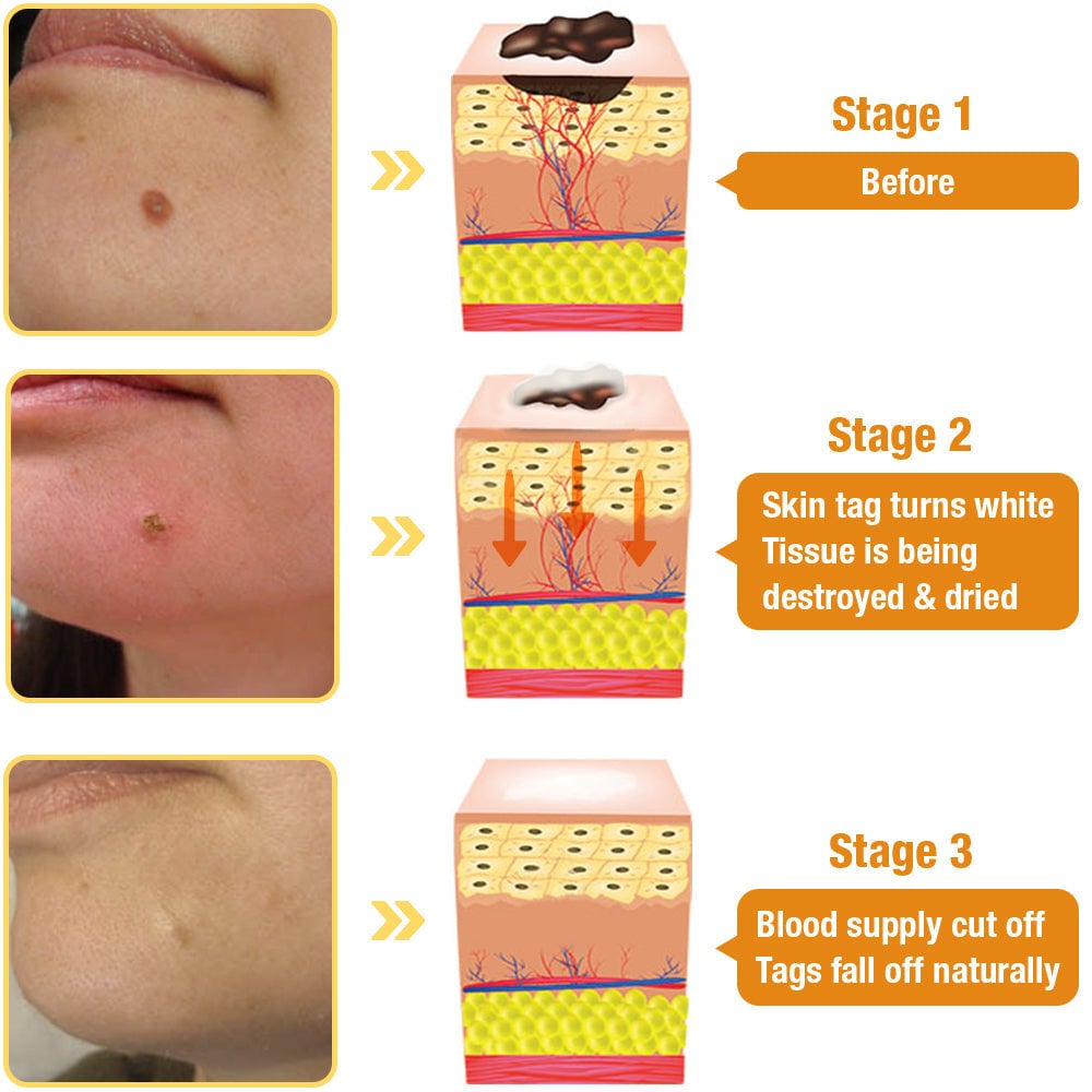 🎁Last Day 50% Off - Bee Venom Treatment Spray