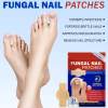 🔥LAST DAY ONLY 50% OFF🔥21 Pcs Fungal Nail Patches⚡BUY 3 GET 1 FREE