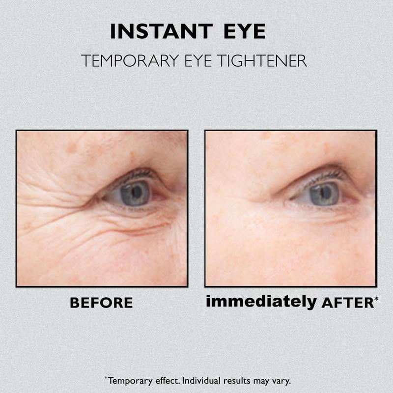 🔥Last Day Promotions 70% OFF🎁Instant Eye Temporary Eye Tightener💕