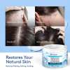⏰LAST DAY SALE 50% OFF💥Seborrheic Dermatitis Cream⚡Buy 2 Get 1 Free&Free Shipping