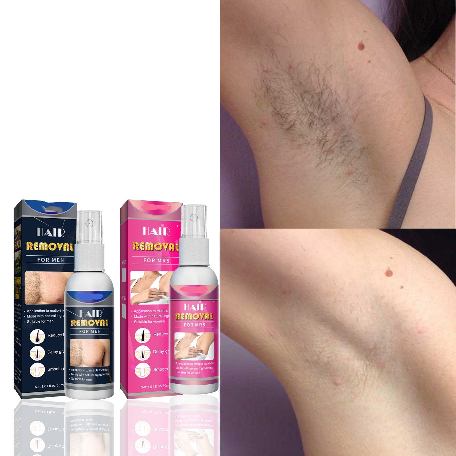 🔥(Early Mother's Day Sale - 50% OFF)Body Hair Removal Spray-Buy 2 Get 2 Free