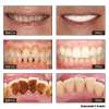 🦷Niacinamide Whitening Toothpaste - For Healthier, Whiter Teeth!✨